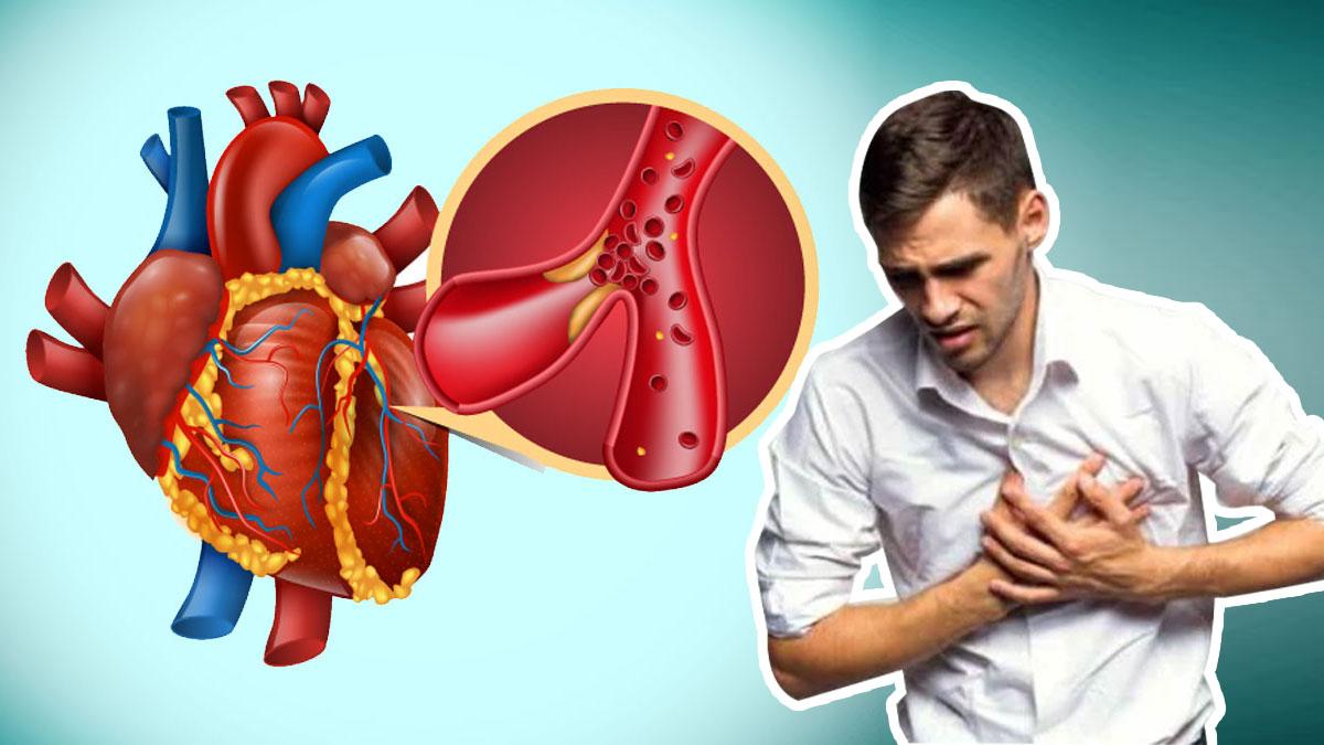 Bệnh tim mạch: Nguyên nhân, triệu chứng và cách điều trị hiệu quả