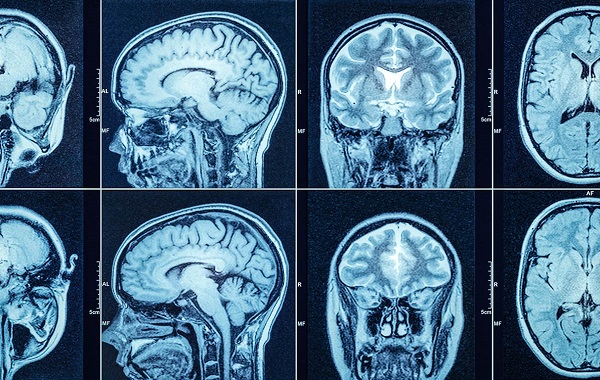 Chụp CT sọ não: Quy trình, chi phí và những điều cần biết trước khi thực hiện