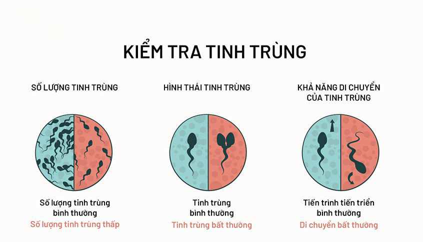Vô sinh nam: Nguyên nhân, dấu hiệu và cách điều trị hiệu quả giúp quý ông lấy lại bản lĩnh sinh sản