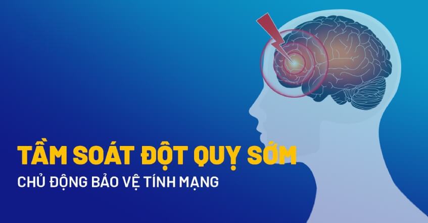 Tầm Soát Đột Quỵ – Phát Hiện Sớm, Bảo Vệ Não Bộ Kịp Thời