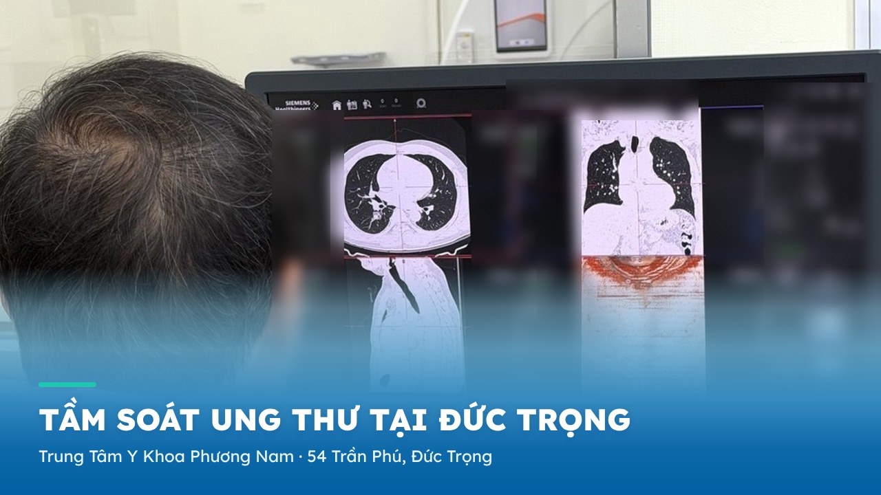 Tầm soát ung thư tại Đức Trọng – Trung Tâm Y Khoa Phương Nam